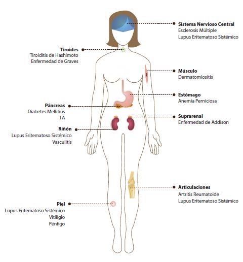 Figura 1. Principales enfermedades autoinmunes (EAI). Se señalan tanto las EAI específi cas de órgano (Ej. Tiroiditis de Hashimoto, esclerosis múltiple) como las sistémicas (Ej. Lupus eritematoso sistémico). 