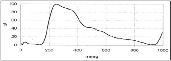 Figura 3. Representación de una onda de pulso con reflexión sistólica y onda diastólica casi inexistente. Se reporta