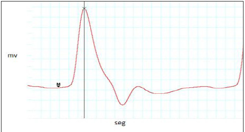 Figura 6. Representación metodológica del análisis de la onda de pulso.