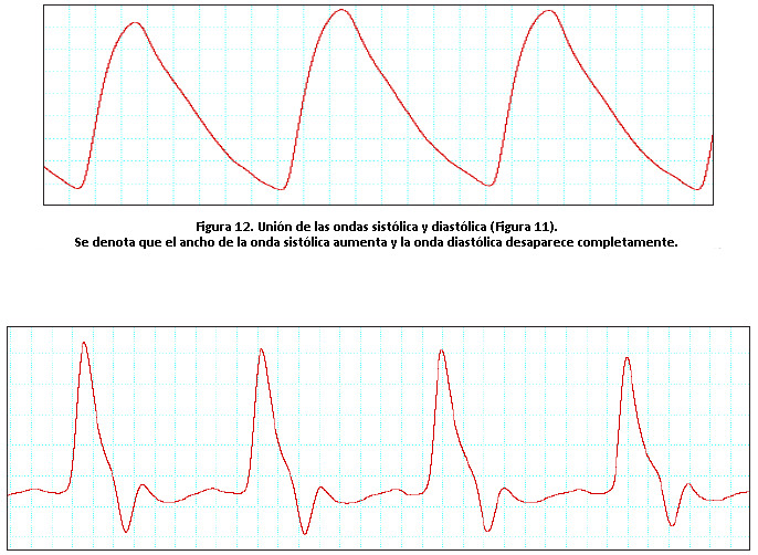 Figura 12. Unión de las ondas sistólica y diastólica (Figura 11).