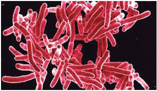 Figura 2. Bacilo tuberculoso