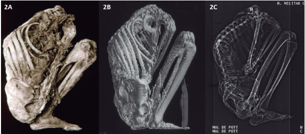 Figura 2. Demostración de tuberculosis en una momia prehispánica colombiana por la ribotipificación del ADN de