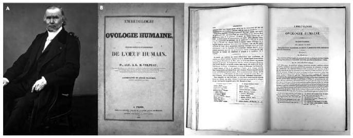 Figura 6A. Alfred-Armand-Louis-Marie Velpeau (1795-1867) fue un anatomista y cirujano francés que nació en
