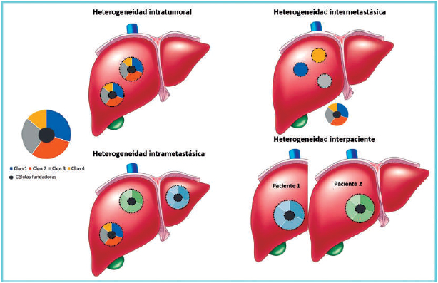 Figura 5. Manifestaciones gráficas de la heterogeneidad tumoral