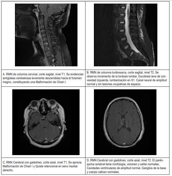 Figura 1. Imágenes de resonancia magnética nuclear (RMN) del paciente.
