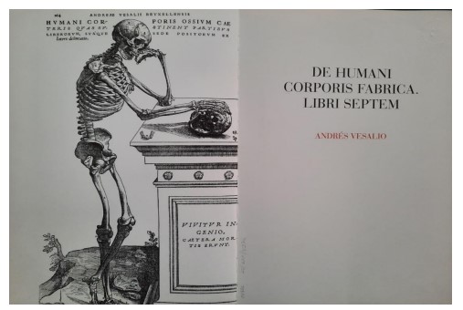 Figura 3. Reproducción facsimilar de la obra Humani corporis fabrica, de Andrés Vesalio. Museo de Historia de la
