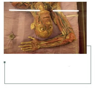 Figura 18: Detalle de modelo anatómico de cuerpo completo 1:1. Museo La Specola, Florencia, Italia. Colección personal.
