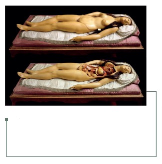 Figura 20: Venus Anatómica. Se aprecia el detalle de la pared abdominal desmontable (35).