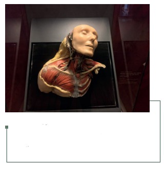 Figura 21: Pieza de la Casa Vasseur. Museo de Medicina, Universidad Nacional Autónoma de México (41).