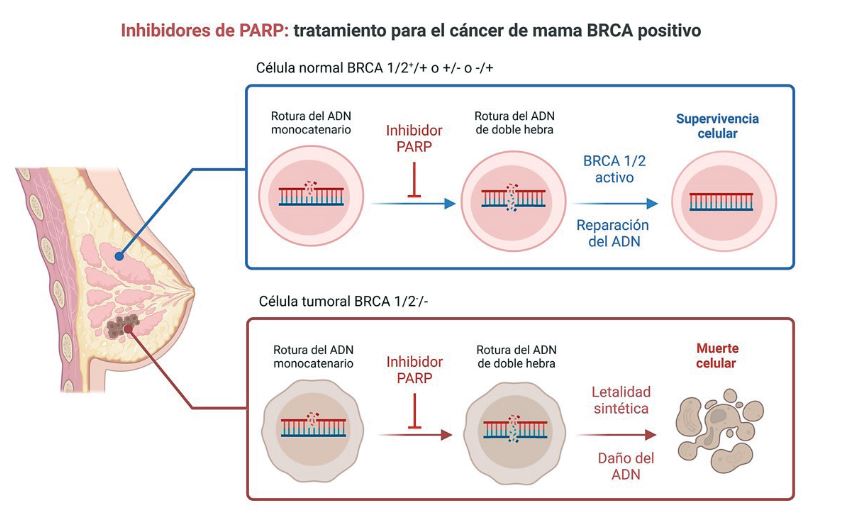 Inhibidores de PARP en cáncer de mama.