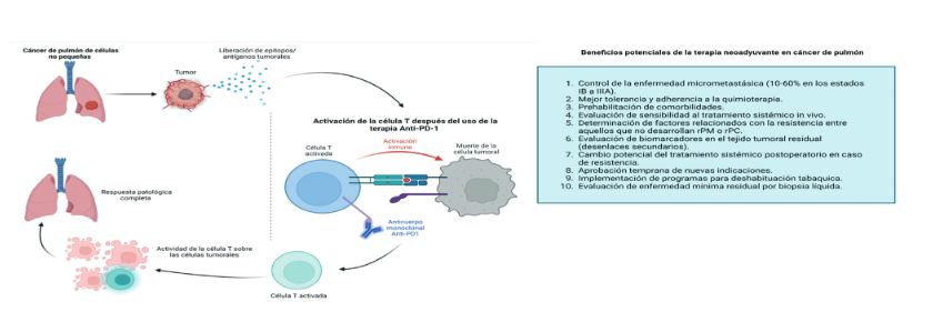 Modelo de activación linfocitaria y acción de la quimioinmunoterapia neoadyuvante en cáncer de pulmon